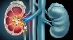 Tratamiento personalizado